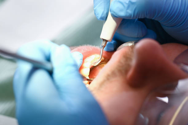 Tooth Infection Emergency Dentist in KS